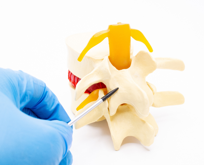 How to Prepare for a Laminectomy?